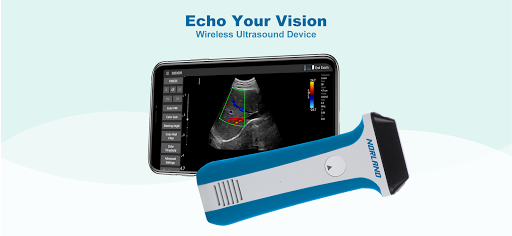 Android application uREzpocus screenshort