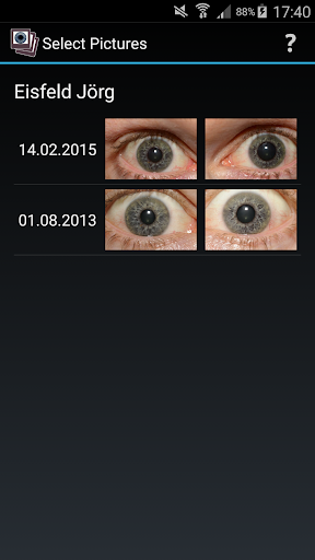 Miniris Screen 3