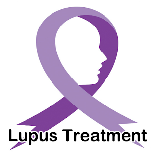 Lupus Symptoms Treatment