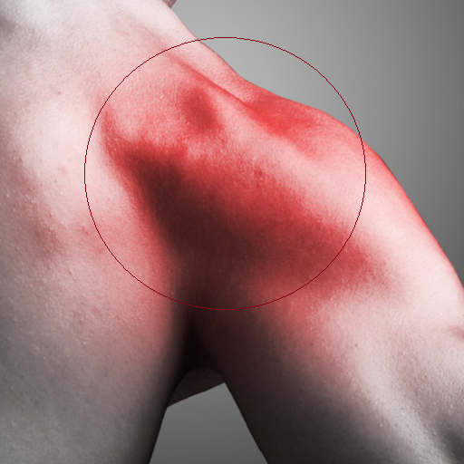 Rotator Cuff упражнение
