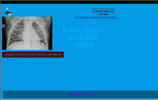 XRay Scan Torso