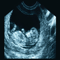 Ultrasound Abdomen + OBGYN Boa