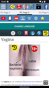 Vaginosis bacteriana Terapia