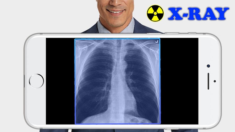 X-Ray Filter Photo  Featured Image for Version 