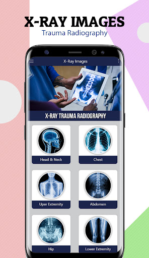 X-Ray Trauma Radiography Screen 2