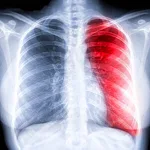 Cover Image of ダウンロード Chest X-ray Easy Guide 5.1.9 APK