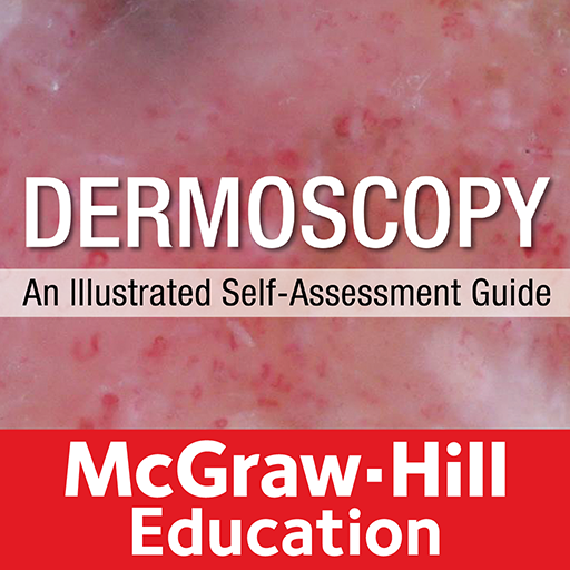 Dermoscopy: An Illustrated Sel