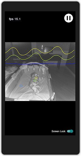 Viewer for Baby Monitor (Xbox) Screen 2