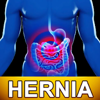 Hernia Diet Help and Food Tips