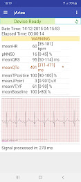 jArtea: ECG and EDF analysis poster 11