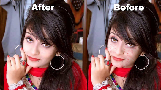 Pimples removing photo editing app 3