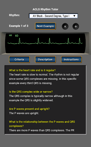 ACLS Rhythm Tutor screenshot 5