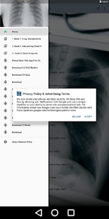 Medical X-Ray Interpretation with 100+ Cases(圖1)-速報App