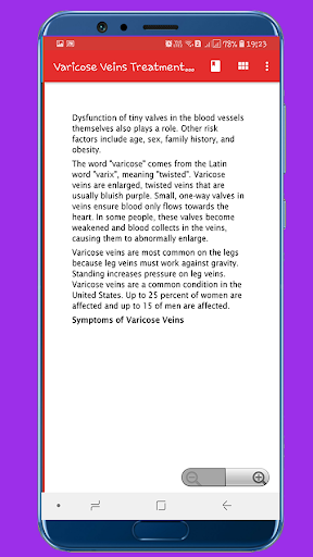 Varicose Veins Treatment by Ho Screen 3