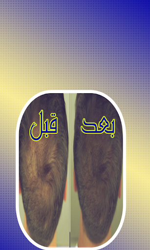 تكثيف و تقوية الشعر