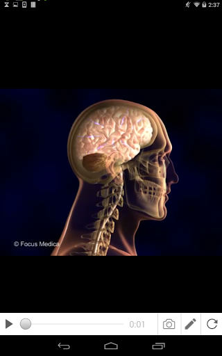 Epilepsy Screen 3