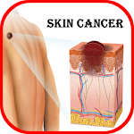Cover Image of ダウンロード Skin Cancer  APK