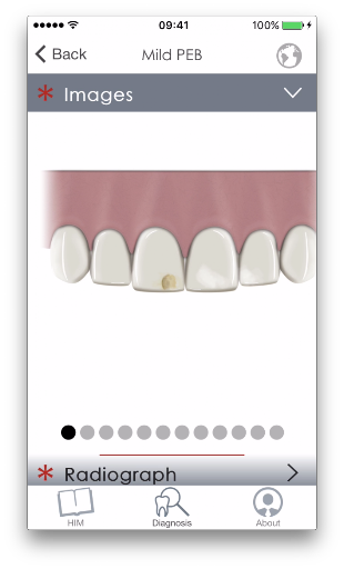 MIH Molar Screenshot 2 - AppWisp.com