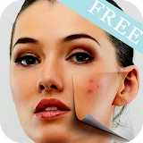 Acne Removing Tips icon