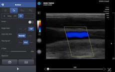 SONON X Ultrasound Appのおすすめ画像5