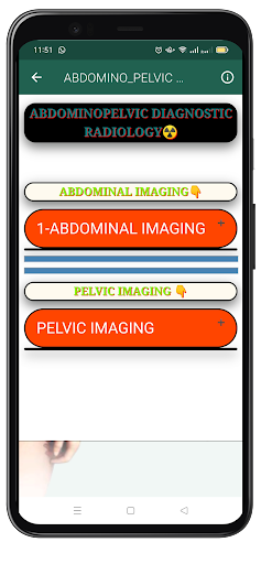 Abdominopelvic Imaging