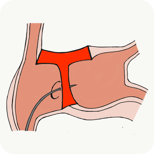 Transeptaid logo