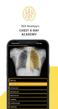 Chest Xray Academy | CXR Casesのおすすめ画像1
