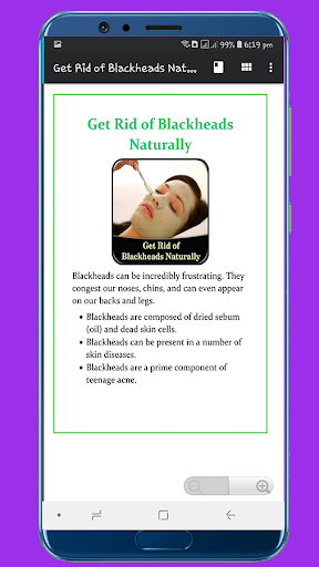 Get Rid of Blackheads Naturally