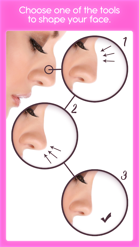 鼻形成術のおすすめ画像2