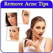 Remove Acne in 7 Days Guide