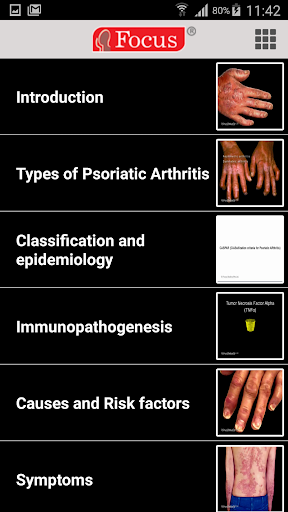 Psoriatic Arthritis Screen 2