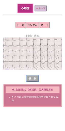 ポケット心電図