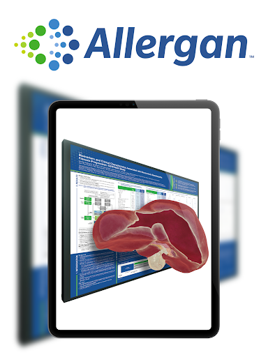 Allergan AR