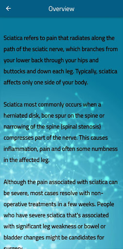 Sciatic Nerve Pain 2022