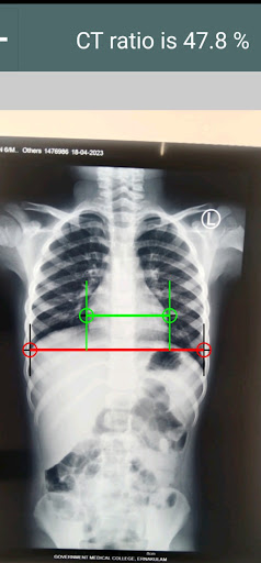 CT Ratio-Xray Screen 3