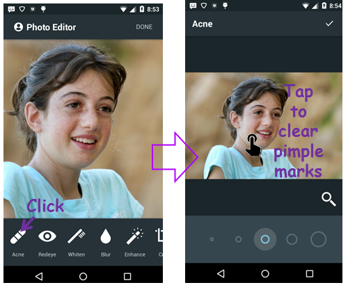 Face Acne Remover Photo Editor Screen 2