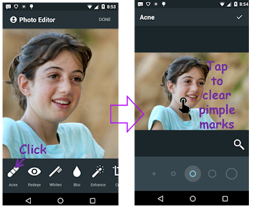 Face Acne Remover Photo Editor App 2.0 APK screenshots 2