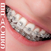 aplicaciones para verse con brackets