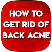 Top 30 Beauty Apps Like HOW TO GET RID OF BACK ACNE - Best Alternatives
