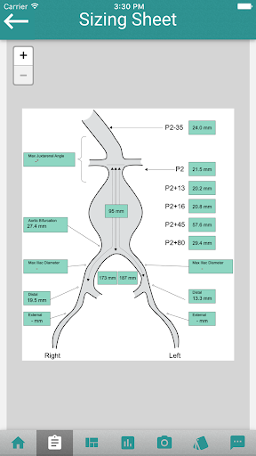Android application EndoSizeMe screenshort