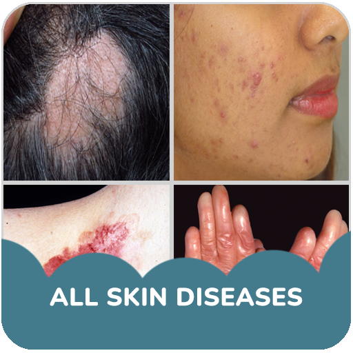 Skin diseases and treatment logo
