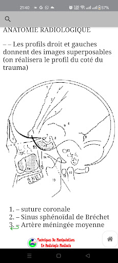 Radiologie Medicale Pro screenshot 16