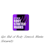 Get Rid of Body Stretch Marks Naturally Apk