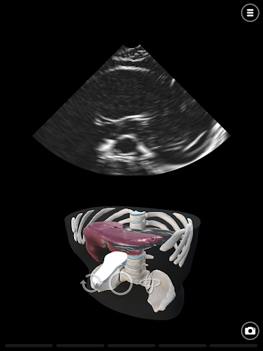 Deepscope Ultrasound Simulator