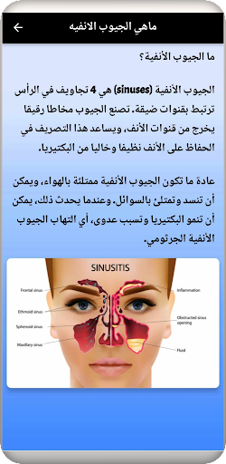 علاج الجيوب الأنفية في المنزل Screen 2
