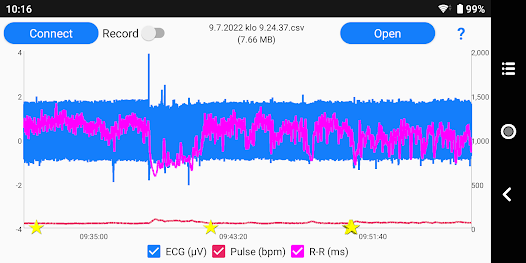 ECG Logger for Polar H10 - Apps on Google Play