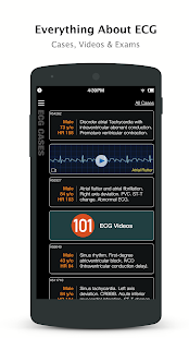 ECG Pro - Real World ECG / EKG Captura de pantalla