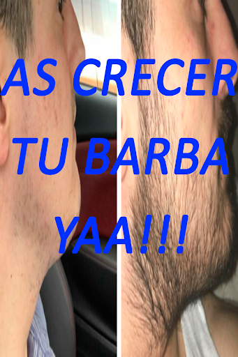 Como hacer crecer la barba