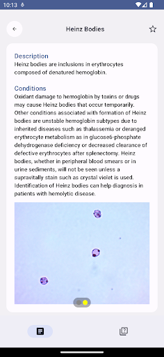 Urinemicro Screen 3