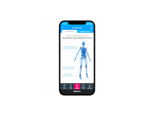 Android application Teleflex Arrow® EZ-IO® App screenshort